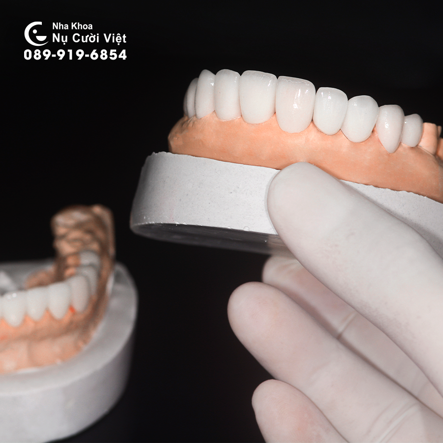 Dán Sứ Veneer và Bọc răng sứ khác nhau như thế nào? 3
