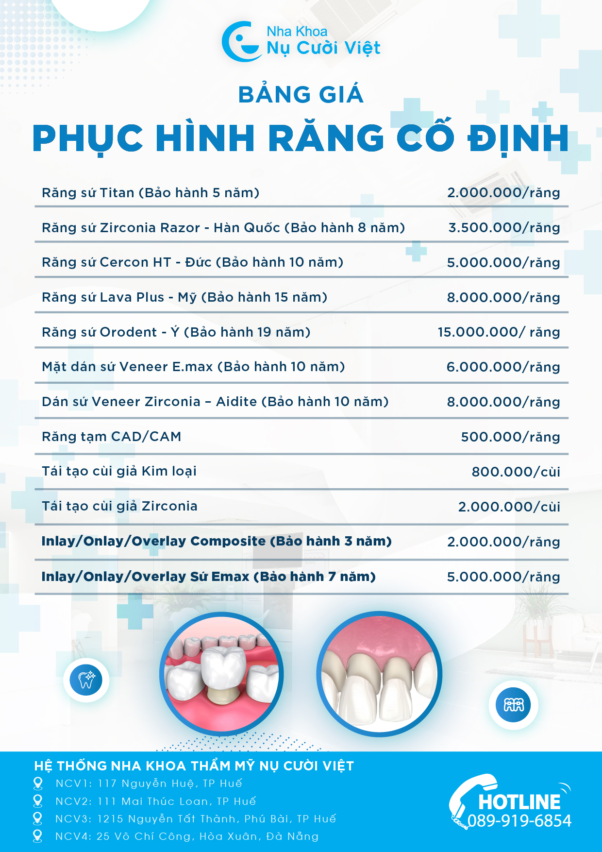 bảng giá bọc răng sứ tại nha khoa nụ cười việt