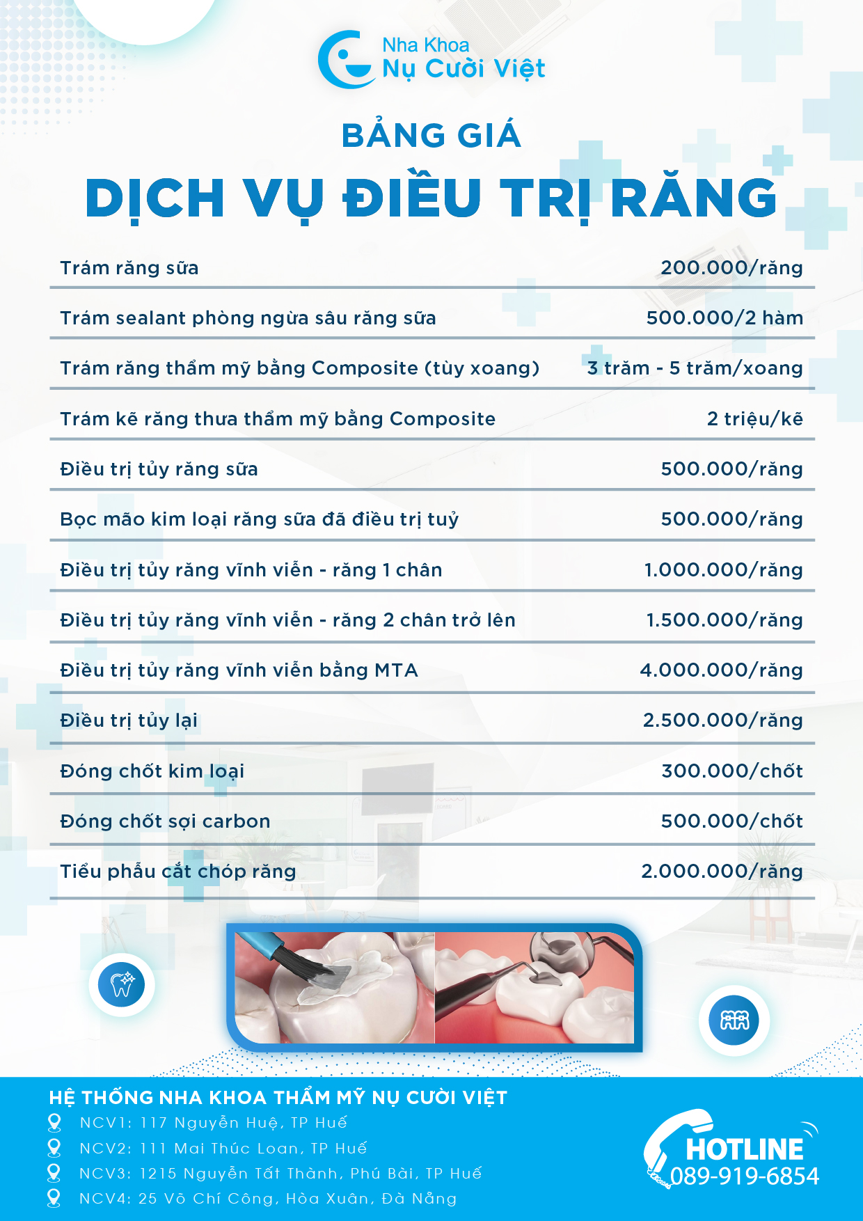bảng giá điều trị răng