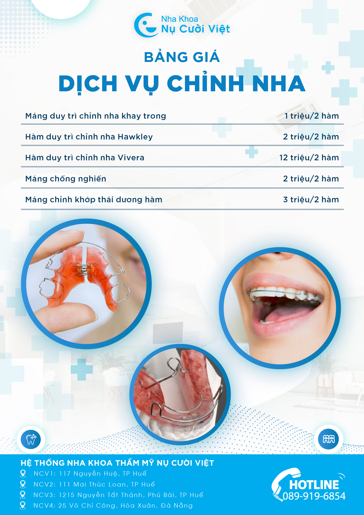 bảng giá hàm duy trì tại nụ cười việt