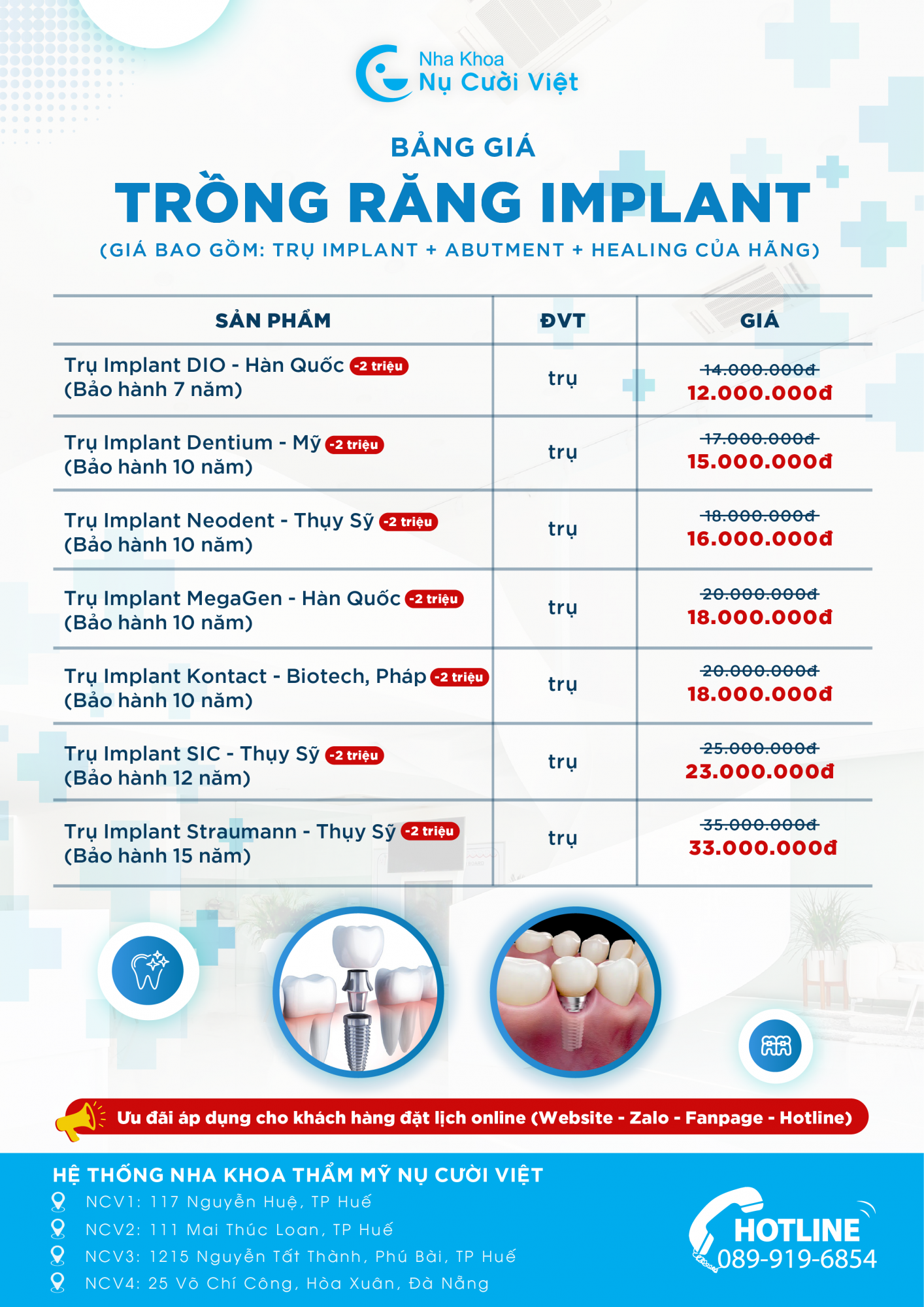 bảng giá implant mới nhất nụ cười việt