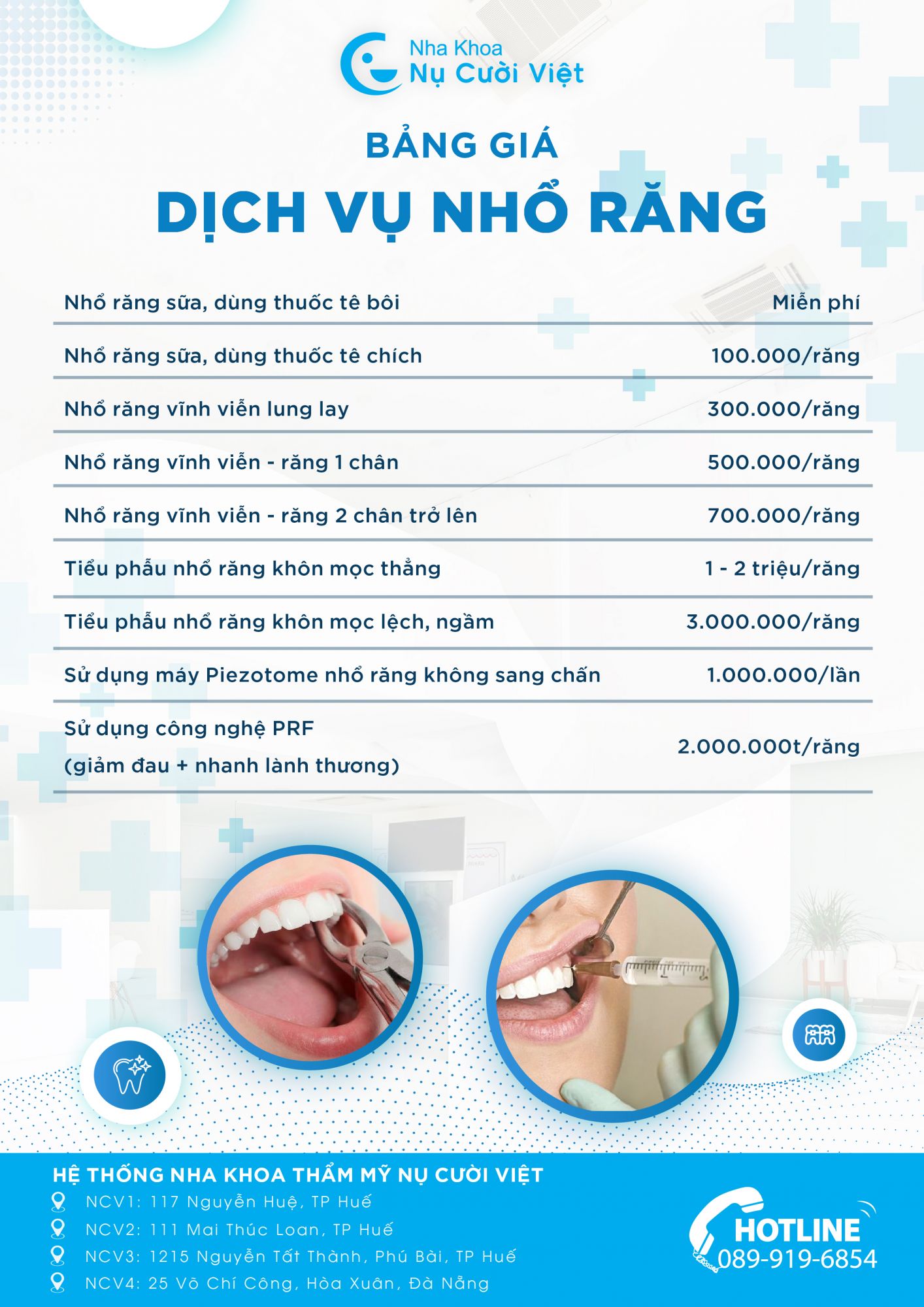 bảng giá nhổ răng tại Nụ Cười Việt