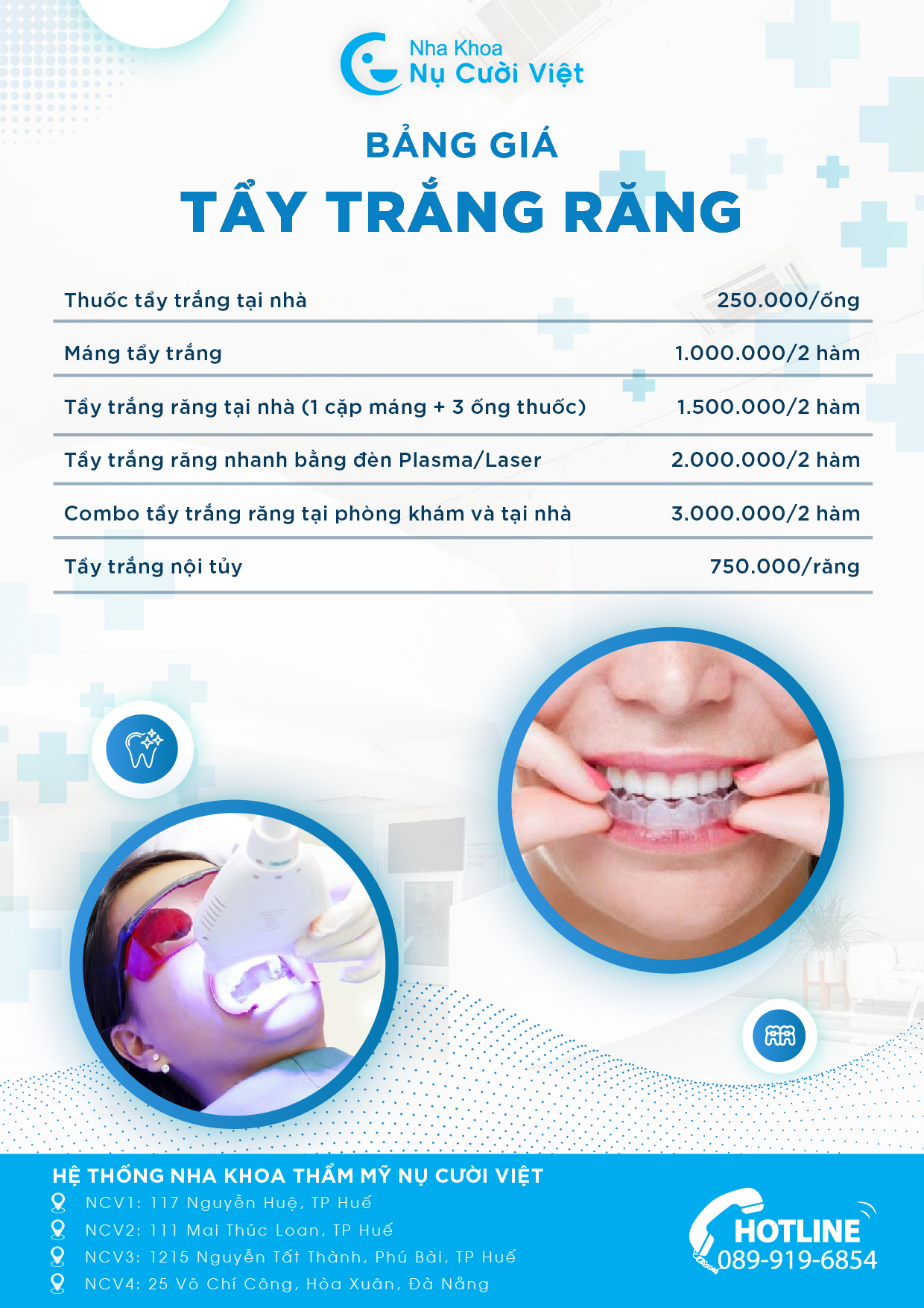 bảng giá tẩy trắng răng