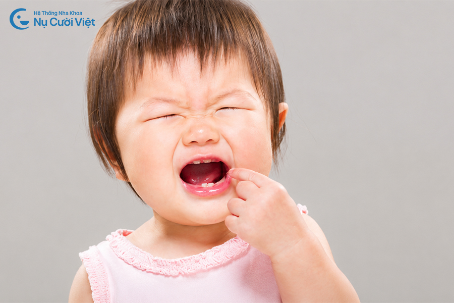 Nụ Cười Việt - Trẻ mấy tháng thì mọc răng? Các giai đoạn mọc răng và dấu hiệu Ba Mẹ cần theo dõi