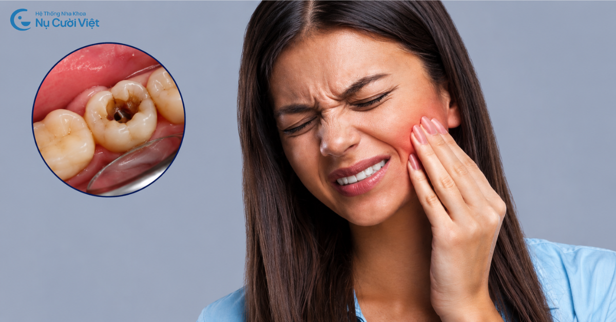 các mức độ sâu răng bạn cần biết