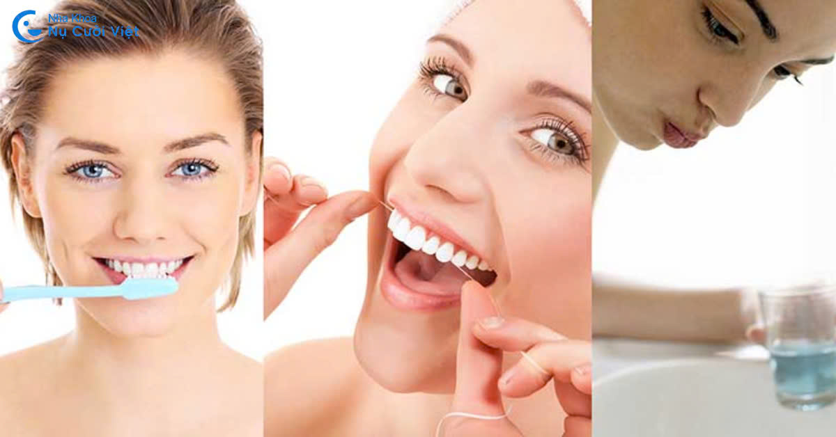 chăm sóc răng miệng sau khi cấy ghép implant