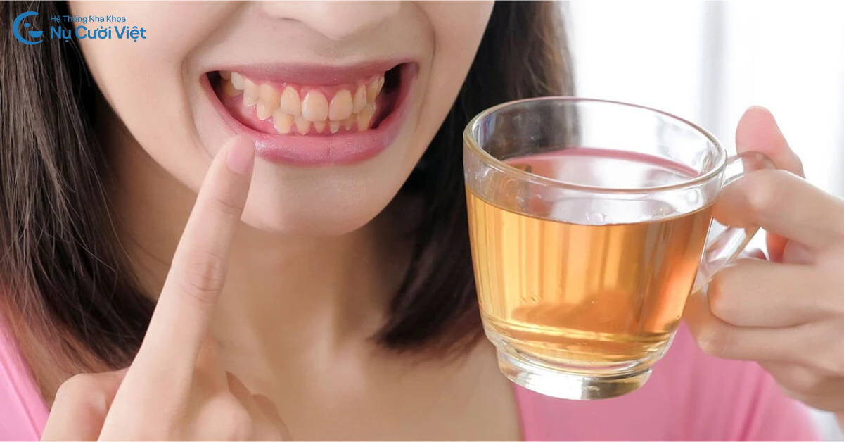 nguyên nhân khiến răng bị nhiễm màu