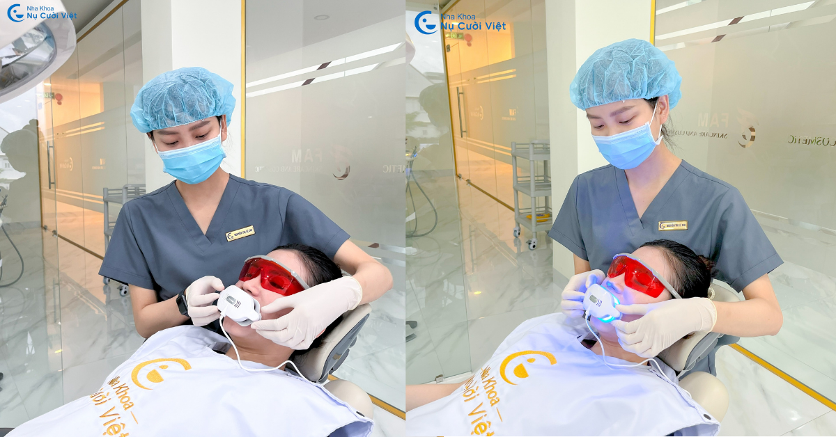 Công nghệ tẩy trắng răng mới nhất của Mỹ - Laser Beyond II Ultra 