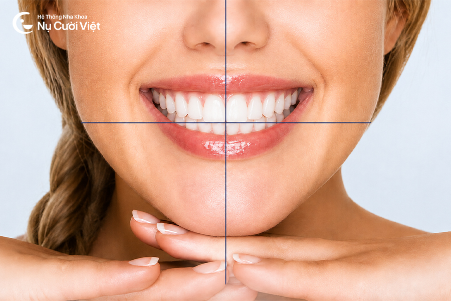 Nụ Cười Việt - Khớp cắn chuẩn là gì? Dấu hiệu nhận biết và cách để có khớp cắn chuẩn?