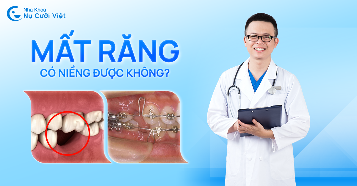 mất răng có niềng được không nha khoa nụ cười việt