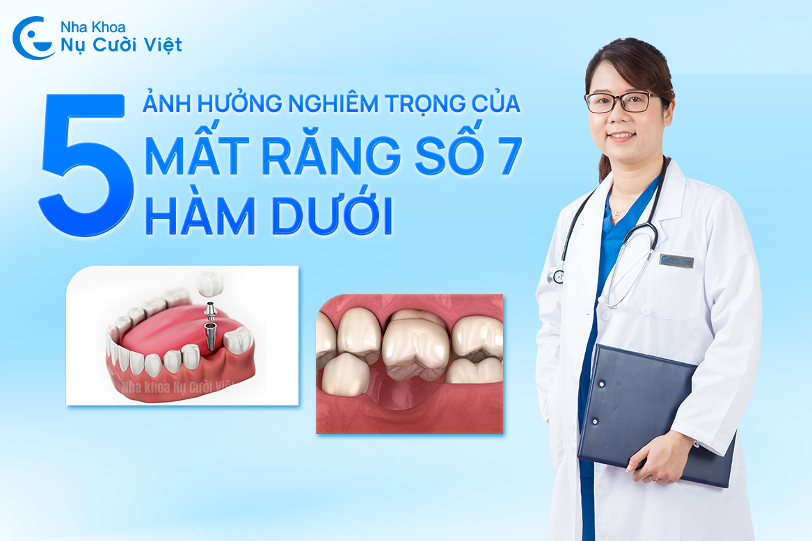 Nụ Cười Việt - MẤT RĂNG SỐ 7 HÀM DƯỚI CÓ NGUY HIỂM KHÔNG? CẢNH BÁO 5 ẢNH HƯỞNG NGHIÊM TRỌNG VÀ GIẢI PHÁP ĐIỀU TRỊ HIỆU QUẢ