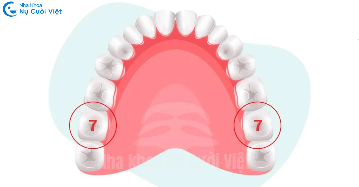 mất răng số 7 có nguy hiểm không