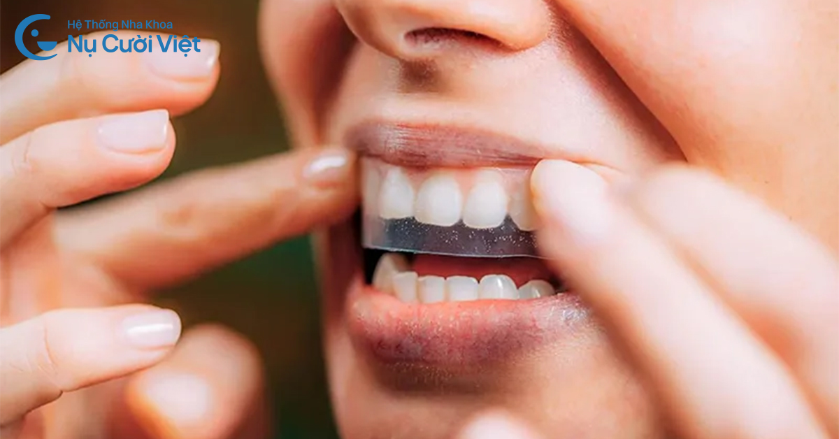 miếng dán tẩy trắng răng