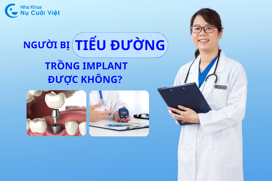 Nụ Cười Việt - NGƯỜI BỊ TIỂU ĐƯỜNG CÓ TRỒNG IMPLANT ĐƯỢC KHÔNG? 