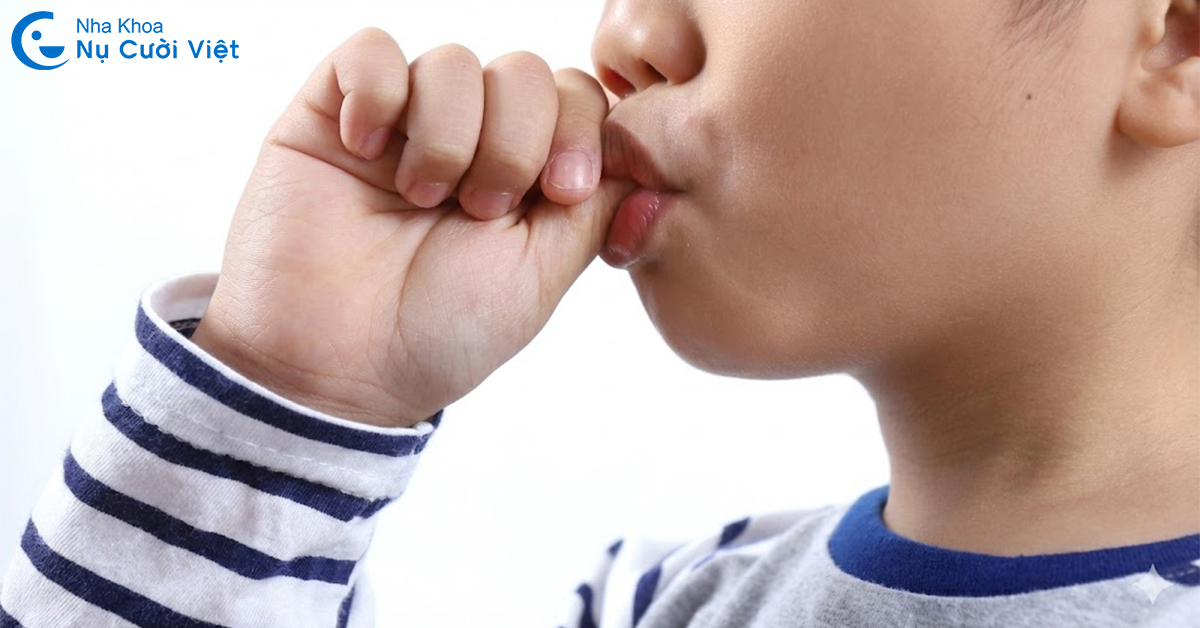 nguyên nhân gây khớp cắn đối đầu