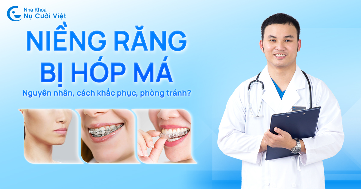 niềng răng bị hóp má