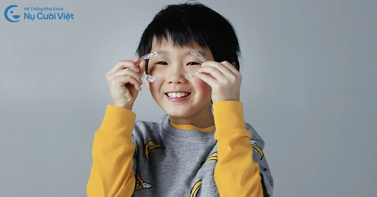 niềng răng khắc phục móm ở trẻ em