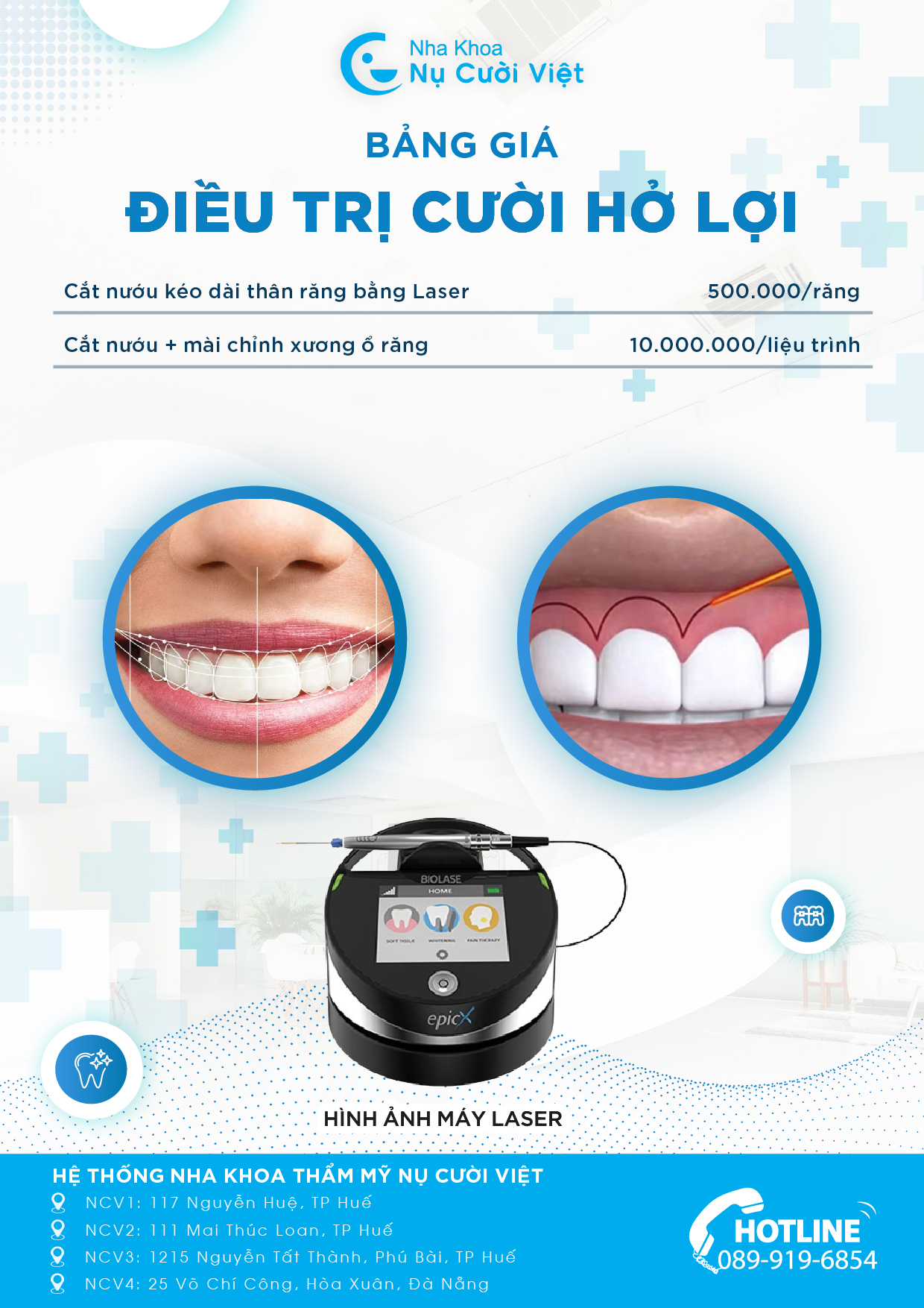 chi phí phẫu thuật cắt nướu tại nụ cười việt