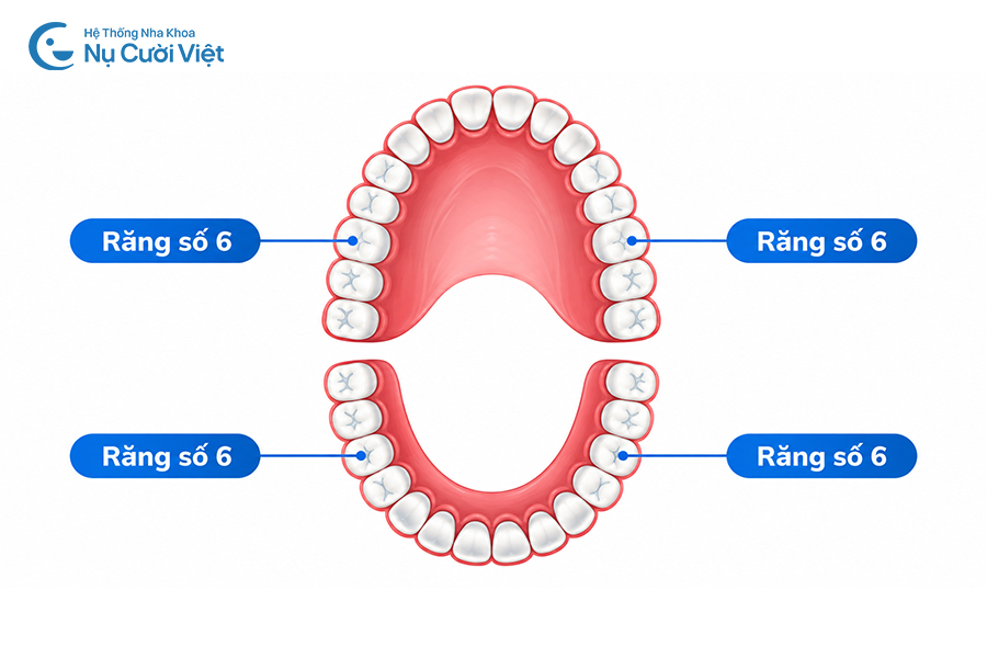 Nụ Cười Việt - Trồng răng số 6: Phương pháp, chi phí và thời gian thực hiện