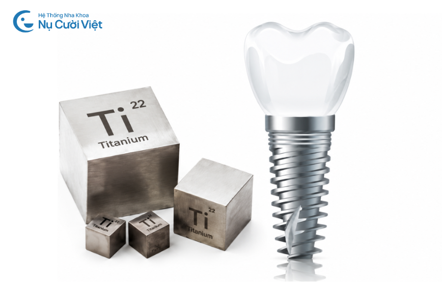 Nụ Cười Việt - Trụ Implant có bị gỉ sét hay oxy hóa theo thời gian không?