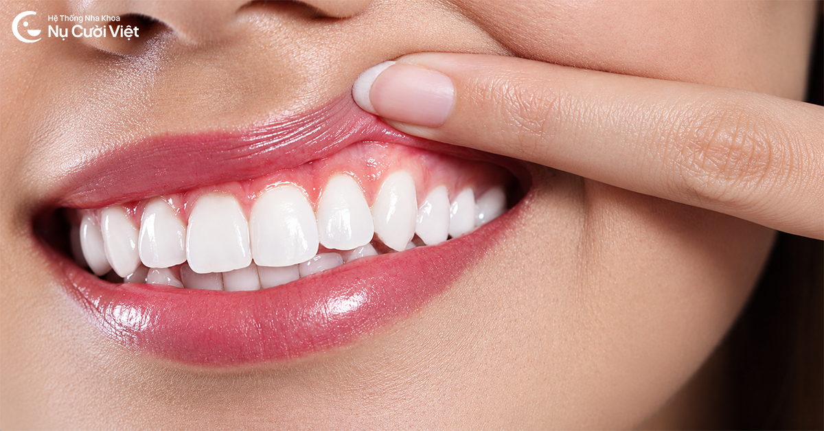 vai trò của fluoride với sức khỏe răng miệng